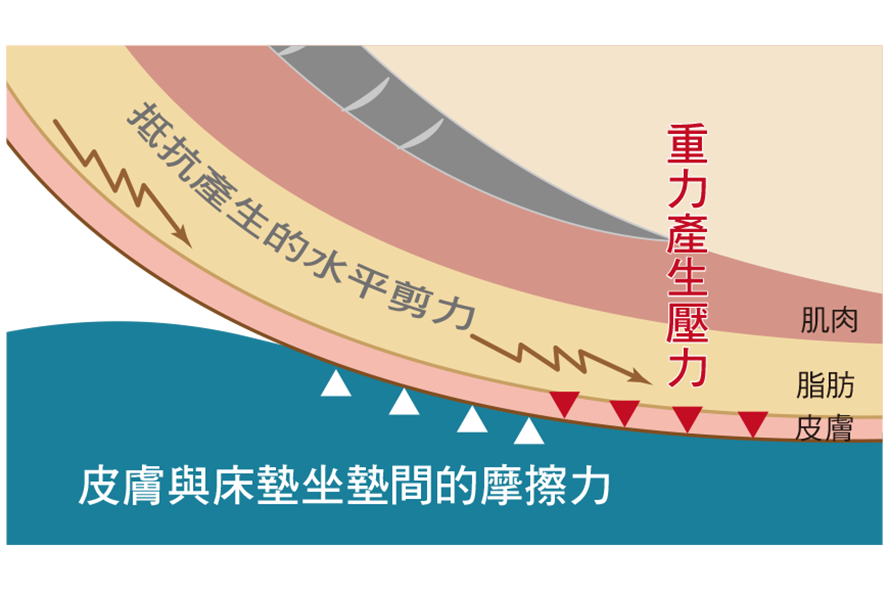 認識壓力性損傷