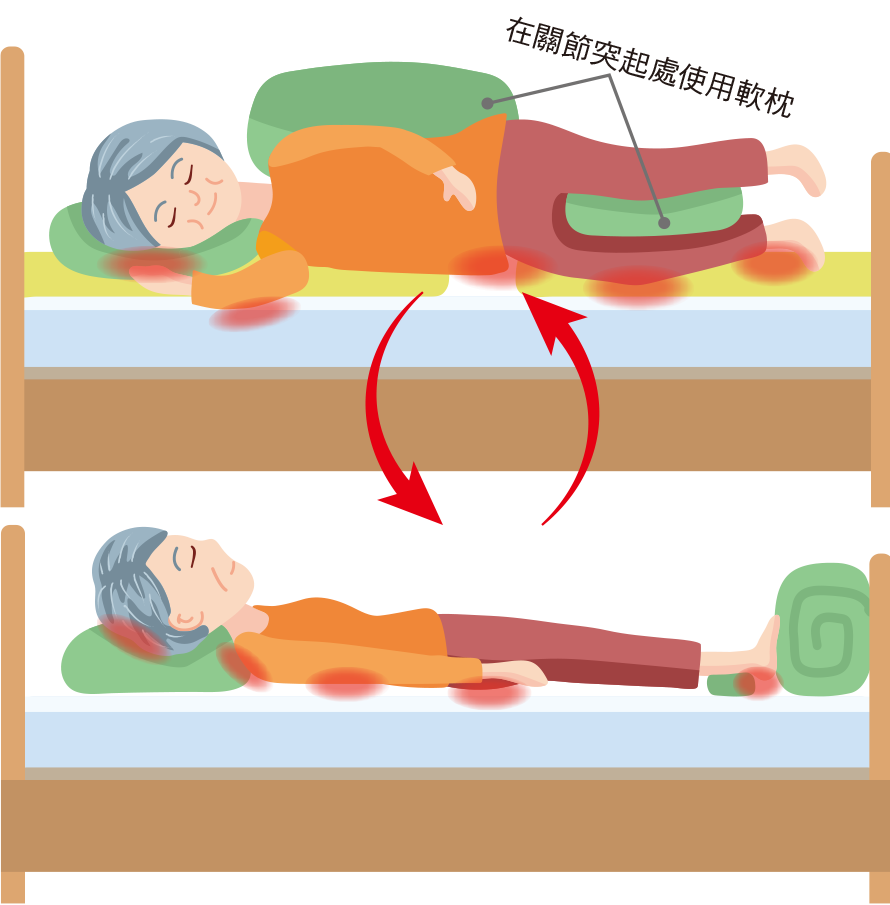 認識壓力性損傷