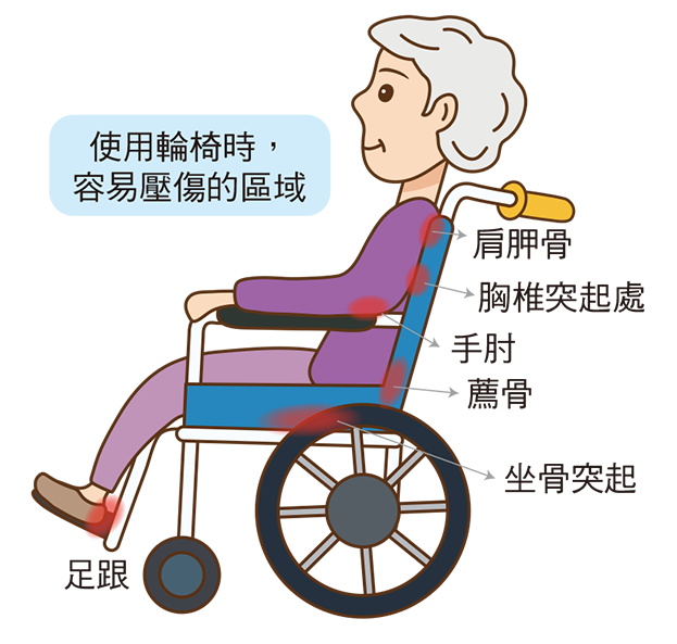 認識壓力性損傷